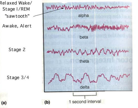 Narcoleptic Brain