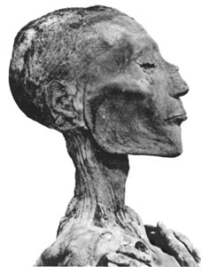 Figure 1 -- a very dead Ramses V (Courtesy of Dr. Alan Cann)