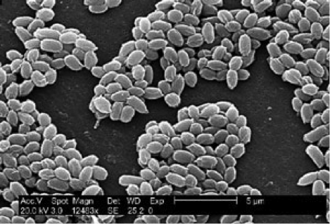 anthrax spores