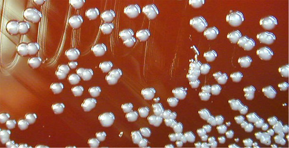 anthrax spores