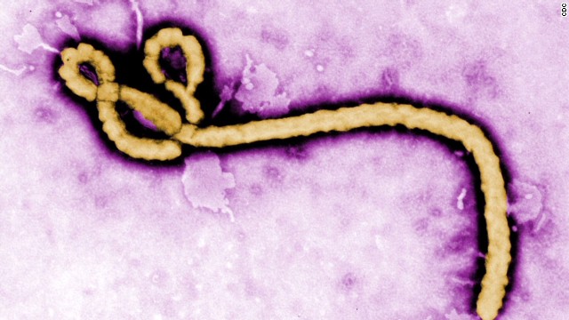 ebolavirus