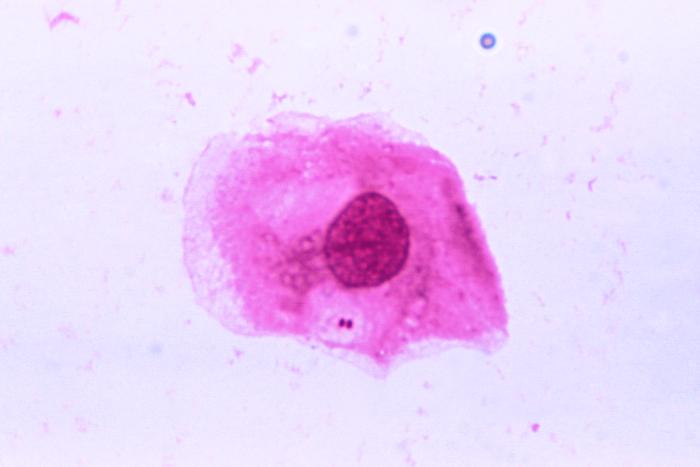 neisseria meningitidis